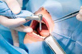 Cirurgia